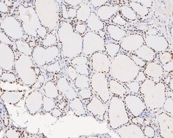 Invitrogen Tat-SF1 Recombinant Rabbit Monoclonal Antibody (JE54-89) 100