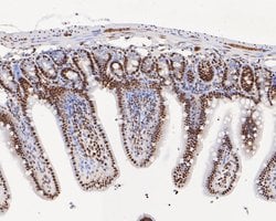 Invitrogen Tat-SF1 Recombinant Rabbit Monoclonal Antibody (JE54-89) 100