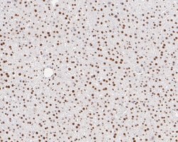 Invitrogen Tat-SF1 Recombinant Rabbit Monoclonal Antibody (JE54-89) 100