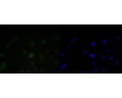 Invitrogen BAT3 Recombinant Rabbit Monoclonal Antibody (JE54-90) 100 &mu;L | Buy Online | Invitrogen&trade; | Fisher Scientific