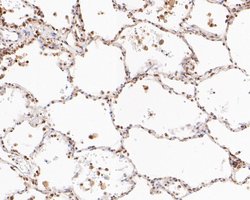 Invitrogen BAT3 Recombinant Rabbit Monoclonal Antibody (JE54-90) 100 &mu;L | Buy Online | Invitrogen&trade; | Fisher Scientific