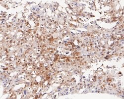 Invitrogen PEX19 Recombinant Rabbit Monoclonal Antibody (JE54-93) 100 &mu;L;