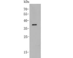 Invitrogen PEX19 Recombinant Rabbit Monoclonal Antibody (JE54-93) 100 &mu;L;