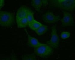 Invitrogen Kallikrein 5 Recombinant Rabbit Monoclonal Antibody (JE54-94)