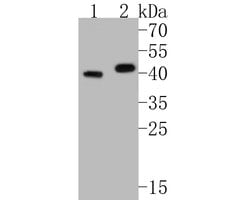 Invitrogen Kallikrein 5 Recombinant Rabbit Monoclonal Antibody (JE54-94)