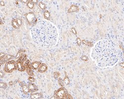 Invitrogen ARG2 Recombinant Rabbit Monoclonal Antibody (JE54-97) 100 &mu;L;