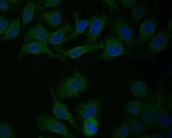 Invitrogen P4HB Recombinant Rabbit Monoclonal Antibody (JE54-98) 100 &mu;L | Buy Online | Invitrogen&trade; | Fisher Scientific