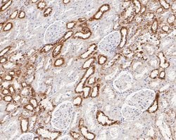 Invitrogen P4HB Recombinant Rabbit Monoclonal Antibody (JE54-98) 100 &mu;L | Buy Online | Invitrogen&trade; | Fisher Scientific