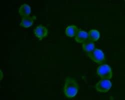 Invitrogen VPS28 Recombinant Rabbit Monoclonal Antibody (JE55-08) 100 &mu;L;