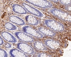 Invitrogen VPS28 Recombinant Rabbit Monoclonal Antibody (JE55-08) 100 &mu;L;