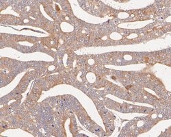Invitrogen VPS28 Recombinant Rabbit Monoclonal Antibody (JE55-08) 100 &mu;L;