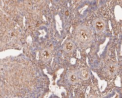 Invitrogen VPS28 Recombinant Rabbit Monoclonal Antibody (JE55-08) 100 &mu;L;