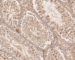 Invitrogen VPS28 Recombinant Rabbit Monoclonal Antibody (JE55-08) 100 &mu;L;