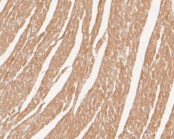 Invitrogen PDLIM1 Recombinant Rabbit Monoclonal Antibody (JE55-21) 100