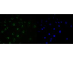 Invitrogen SUPT5H Recombinant Rabbit Monoclonal Antibody (JE55-25) 100