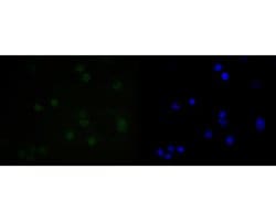 Invitrogen SUPT5H Recombinant Rabbit Monoclonal Antibody (JE55-25) 100