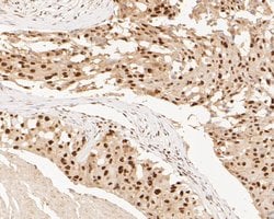 Invitrogen SUPT5H Recombinant Rabbit Monoclonal Antibody (JE55-25) 100