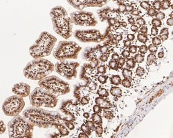 Invitrogen SUPT5H Recombinant Rabbit Monoclonal Antibody (JE55-25) 100