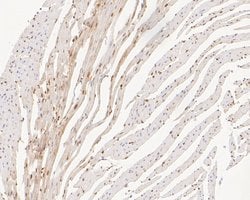 Invitrogen SUPT5H Recombinant Rabbit Monoclonal Antibody (JE55-25) 100