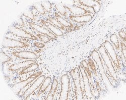 Invitrogen SUPT5H Recombinant Rabbit Monoclonal Antibody (JE55-25) 100
