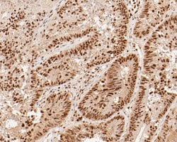 Invitrogen SUPT5H Recombinant Rabbit Monoclonal Antibody (JE55-25) 100