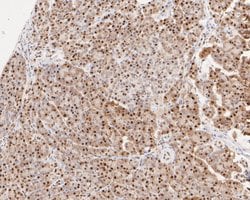 Invitrogen SUPT5H Recombinant Rabbit Monoclonal Antibody (JE55-25) 100