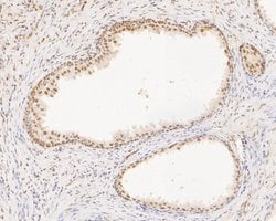 Invitrogen SUPT5H Recombinant Rabbit Monoclonal Antibody (JE55-25) 100