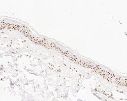 Invitrogen SUPT5H Recombinant Rabbit Monoclonal Antibody (JE55-25) 100