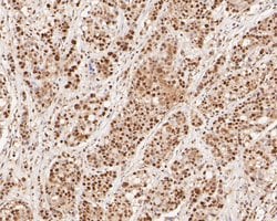 Invitrogen SUPT5H Recombinant Rabbit Monoclonal Antibody (JE55-25) 100