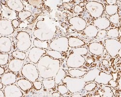 Invitrogen SUPT5H Recombinant Rabbit Monoclonal Antibody (JE55-25) 100