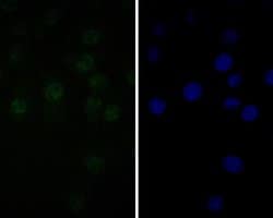 Invitrogen TEF1 Recombinant Rabbit Monoclonal Antibody (JE52-71) 100 &mu;L;