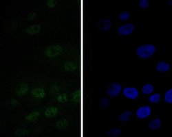 Invitrogen TEF1 Recombinant Rabbit Monoclonal Antibody (JE52-71) 100 &mu;L;