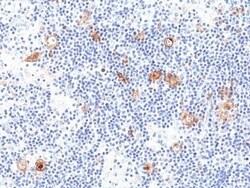 Invitrogen CD30 Recombinant Rabbit Monoclonal Antibody (RM425) 100 &mu;L;
