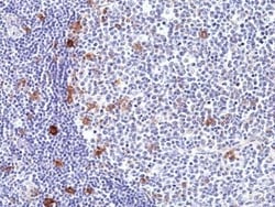 Invitrogen CD30 Recombinant Rabbit Monoclonal Antibody (RM425) 100 &mu;L;