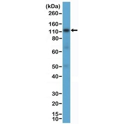 Invitrogen CD30 Recombinant Rabbit Monoclonal Antibody (RM425) 100 &mu;L;