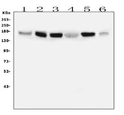 Invitrogen IRS1 Monoclonal Antibody (10I3) 100 &mu;g; Unconjugated:Antibodies,