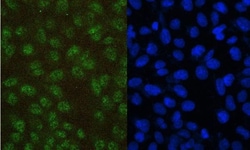 Invitrogen PAX5 Monoclonal Antibody (6I4) 100 &mu;g; Unconjugated:Antibodies,