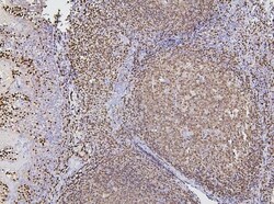 Invitrogen PAX5 Monoclonal Antibody (6I4) 100 &mu;g; Unconjugated:Antibodies,