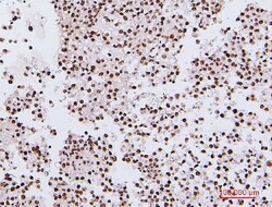 Invitrogen NRF1 Monoclonal Antibody (2G4) 100 &mu;g | Buy Online | Invitrogen&trade; | Fisher Scientific
