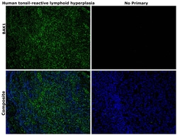 Invitrogen BAK1 Monoclonal Antibody (4C2) 100 &mu;g; Unconjugated:Anticuerpos