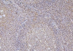 Invitrogen BAK1 Monoclonal Antibody (4C2) 100 &mu;g; Unconjugated:Anticuerpos