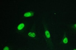 Invitrogen RPA70 Monoclonal Antibody (11H4) 100 &mu;g; Unconjugated:Antibodies,