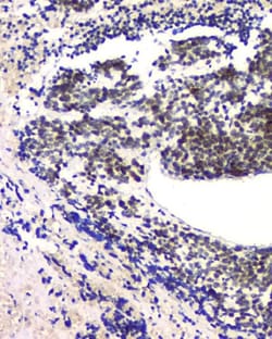 Invitrogen RPA70 Monoclonal Antibody (11H4) 100 &mu;g; Unconjugated:Antibodies,
