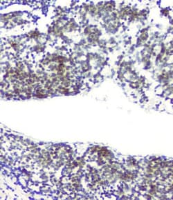 Invitrogen RPA70 Monoclonal Antibody (11H4) 100 &mu;g; Unconjugated:Antibodies,