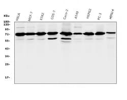 Invitrogen RPA70 Monoclonal Antibody (11H4) 100 &mu;g; Unconjugated:Antibodies,