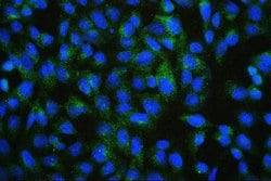 Invitrogen PDCD6IP Monoclonal Antibody (14D10) 100 &mu;g; Unconjugated:Antibodies,
