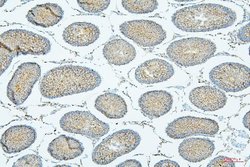 Invitrogen PDCD6IP Monoclonal Antibody (14D10) 100 &mu;g; Unconjugated:Antibodies,