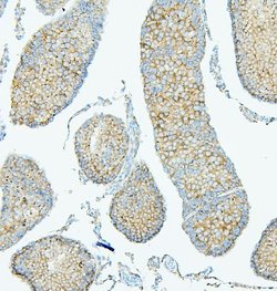 Invitrogen PDCD6IP Monoclonal Antibody (14D10) 100 &mu;g; Unconjugated:Antibodies,