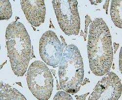 Invitrogen PDCD6IP Monoclonal Antibody (14D10) 100 &mu;g; Unconjugated:Antibodies,
