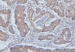 Invitrogen PDCD6IP Monoclonal Antibody (14D10) 100 &mu;g; Unconjugated:Antibodies,